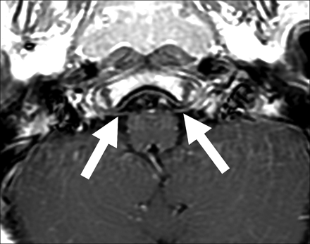 Fig 6.
