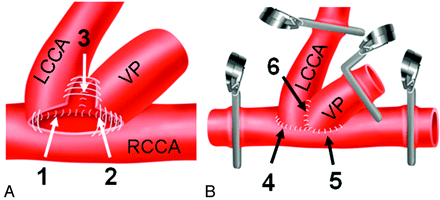 Fig 3.