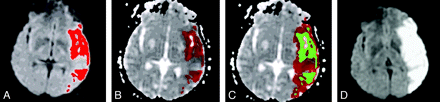 Fig 1.