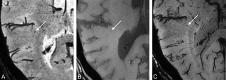 Fig 4.