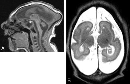 Fig 4.