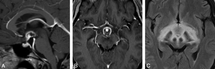 Fig 1.