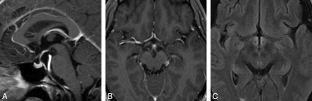 Fig 2.