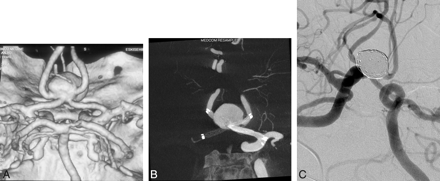 Fig 1.