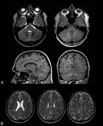 Fig 1.