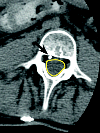 Fig 11.