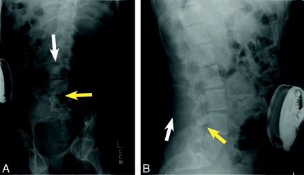 Fig 5.