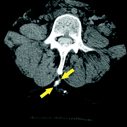 Fig 9.
