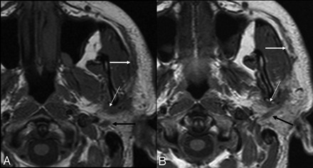 Fig 3.