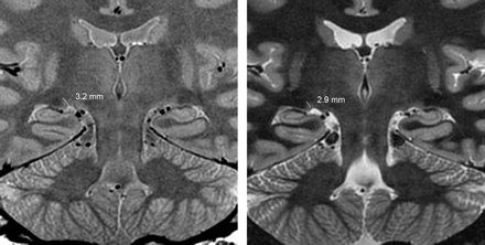 Fig 4.