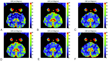 Fig 3.