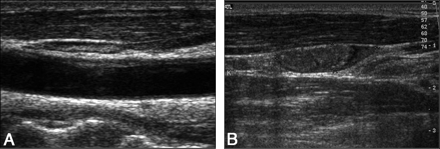 Fig 1.