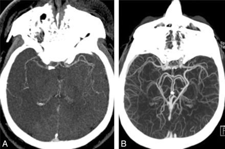 Fig 2.
