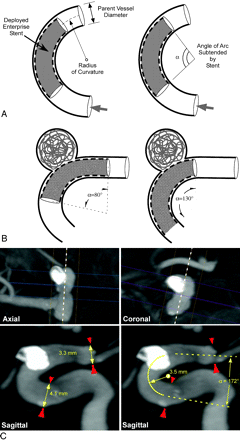 Fig 3.