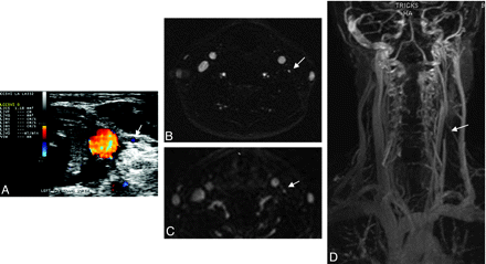 Fig 3.
