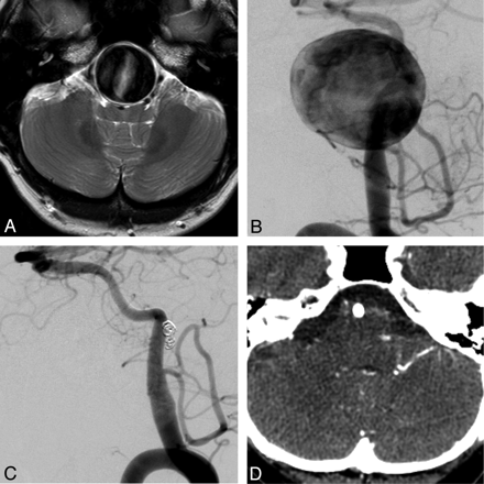 Fig 4.