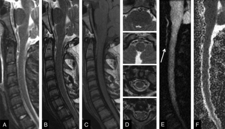 Fig 4.