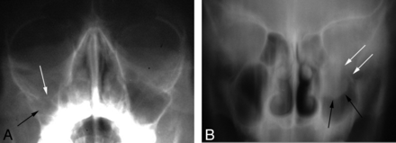 Fig 1.
