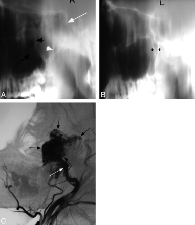Fig 5.