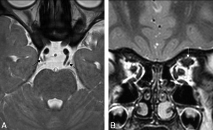 Fig 5.