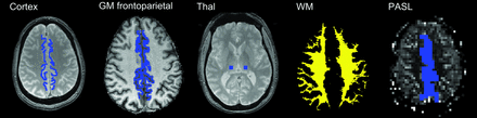 Fig 1.