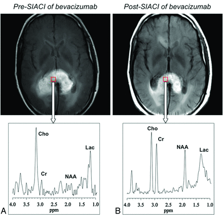 Fig 3.