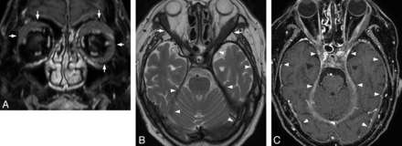 Fig 3.