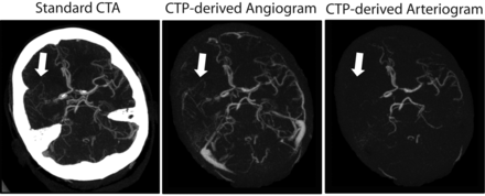 Fig 3.
