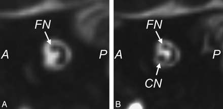 Fig 10.