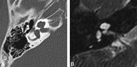 Fig 2.