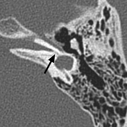 Fig 3.
