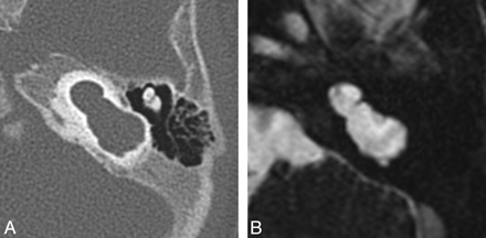 Fig 4.