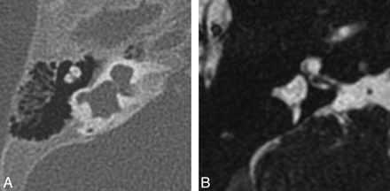 Fig 5.