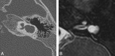 Fig 6.