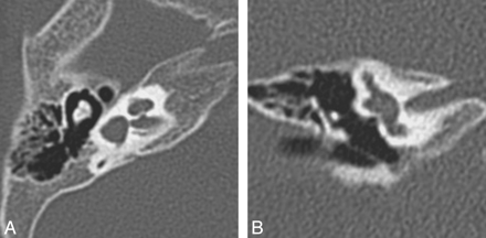 Fig 8.