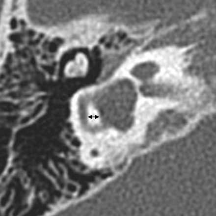 Fig 9.