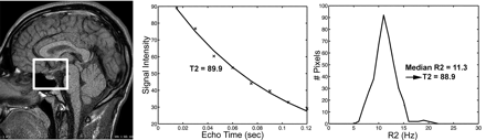 Fig 1.