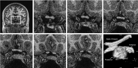 Fig 2.