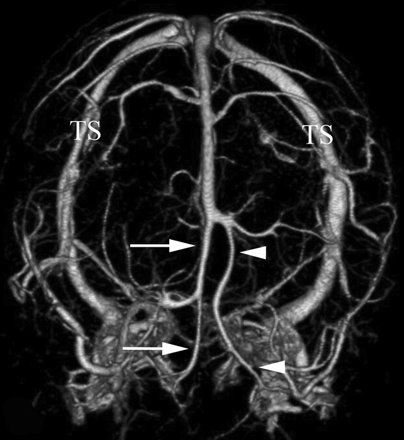 Fig 2.