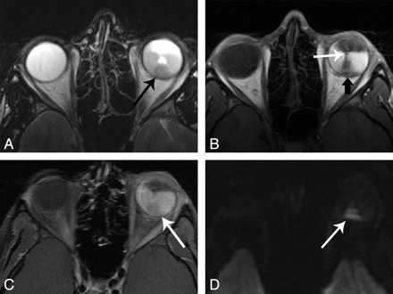 Fig 4.
