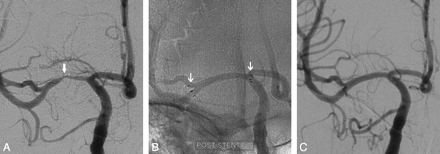 Fig 1.