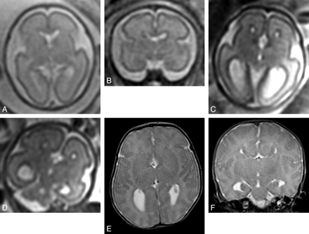 Fig 2.