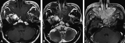 Fig 1.