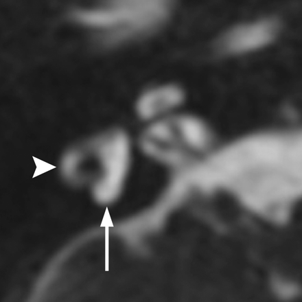Fig 3.
