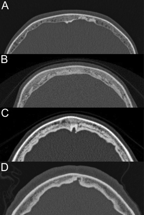 Fig 6.