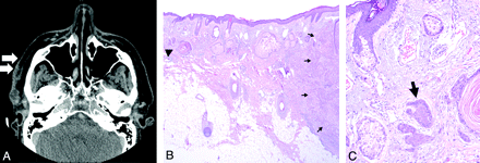 Fig 1.