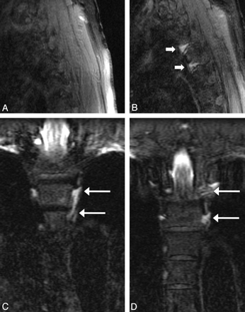 Fig 3.
