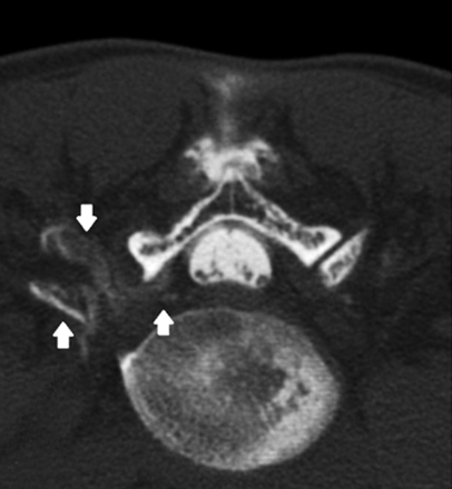 Fig 2.
