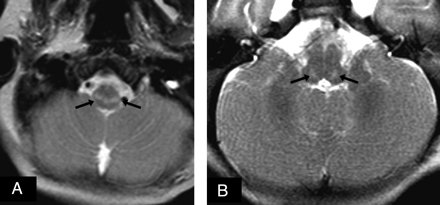 Fig 1.