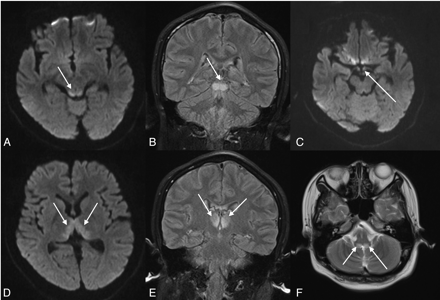Fig 1.
